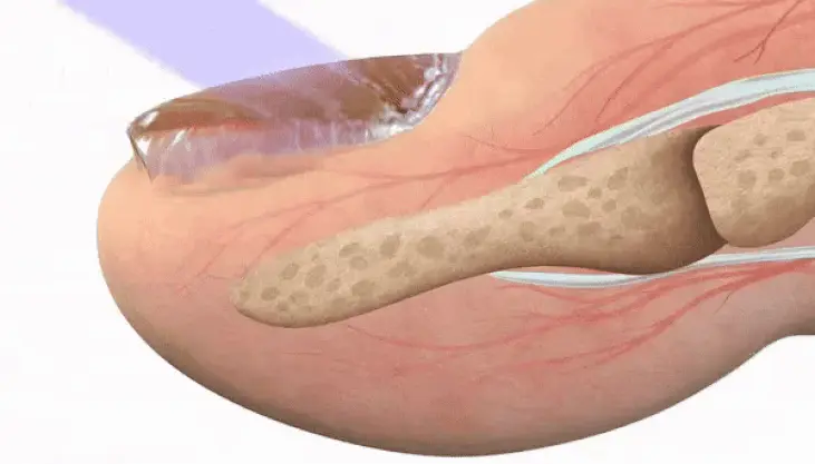 FINAL VERDICT: Fungabeam Delivers What Creams and Pills Can't
